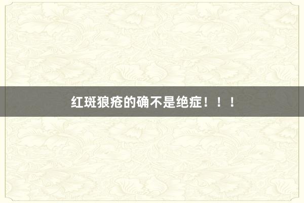 红斑狼疮的确不是绝症！！！